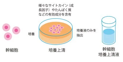 aura-international-03-01